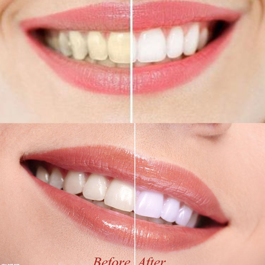 Bamboo Charcoal Teeth Tooth De – обзор и цена Teeth Whitening Quotes