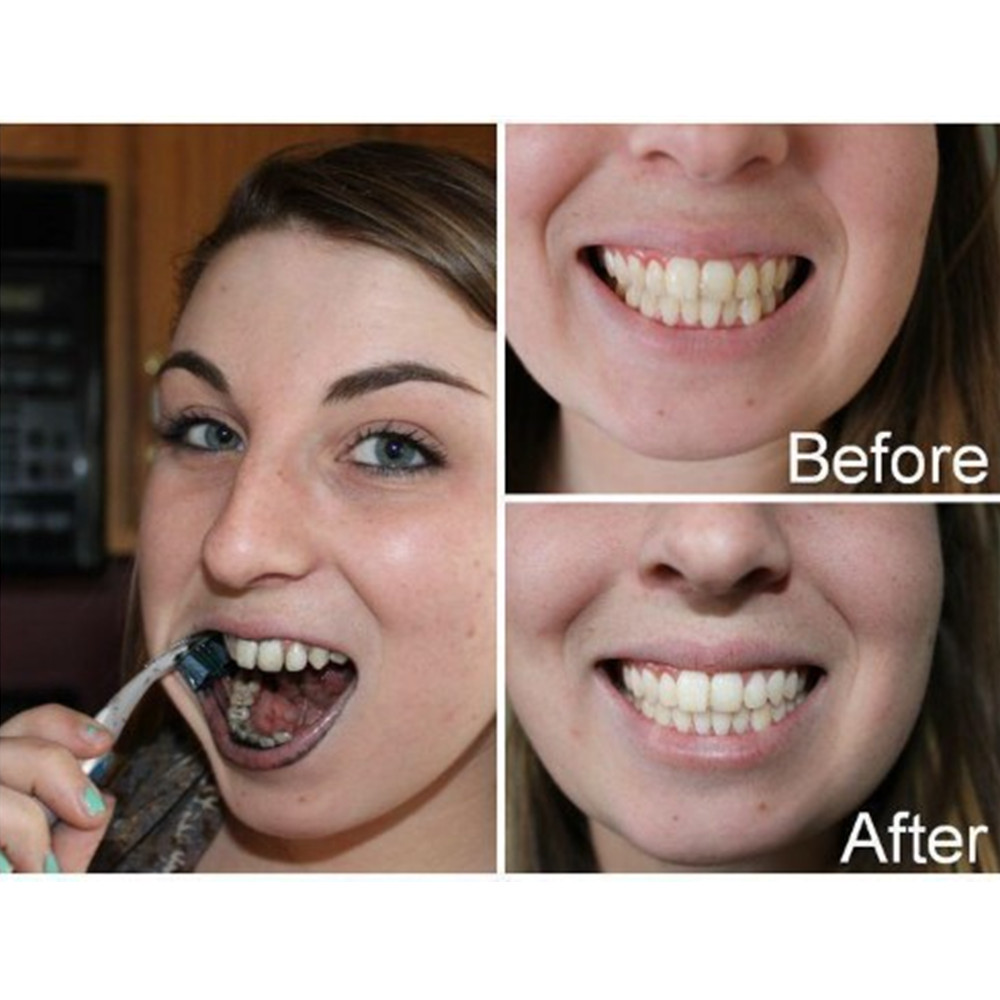 Bamboo Charcoal Teeth Tooth De – обзор и цена Teeth Whitening Quotes