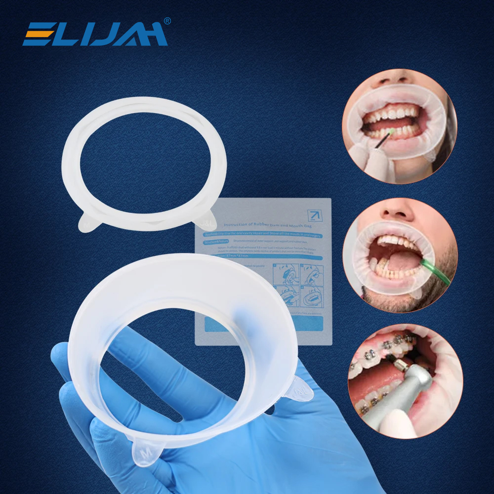 ELIJAH Dental Rubber Mouth Ope – обзор и цена Teeth Whitening Zoom
