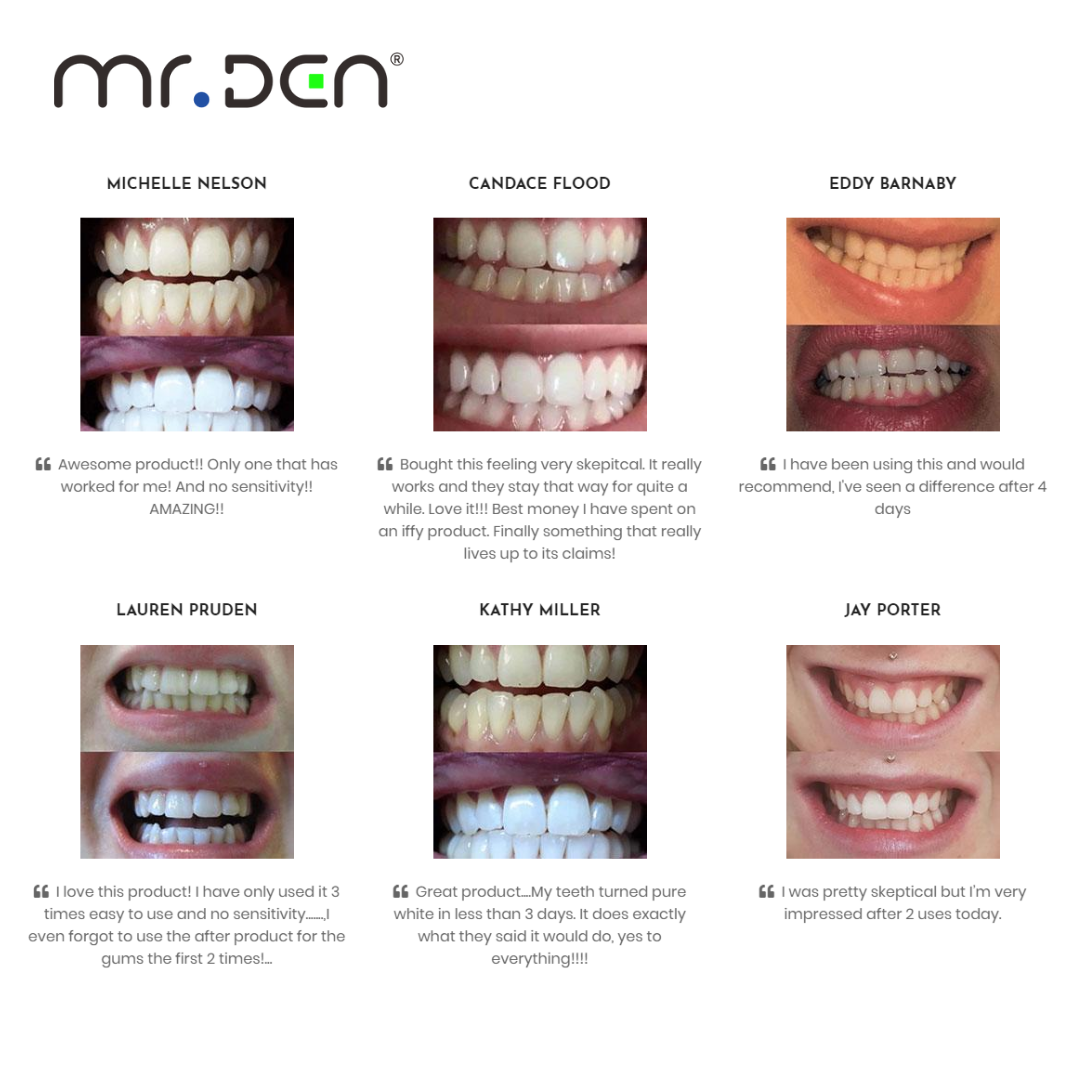 Dr. Whiten 3 Pack Teeth Whiten – обзор и цена Whitening Teeth Machine