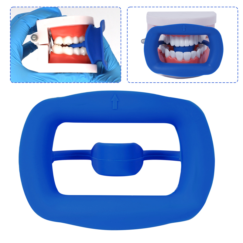 1pc Dental Mouth Opener Soft S – обзор и цена Teeth Whitening Zoom