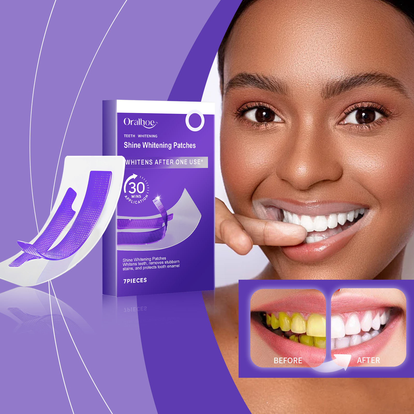 Purple Teeth Whitening Strips  – обзор и цена Teeth Whitening Quotes