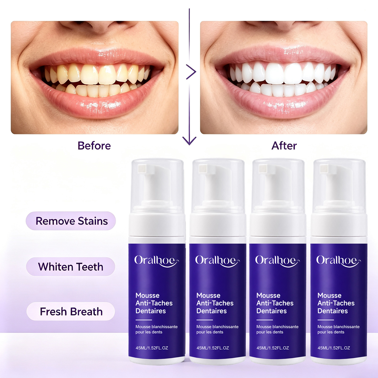 Purple Foaming Teeth Whitening – обзор и цена Teeth Whitening Routine