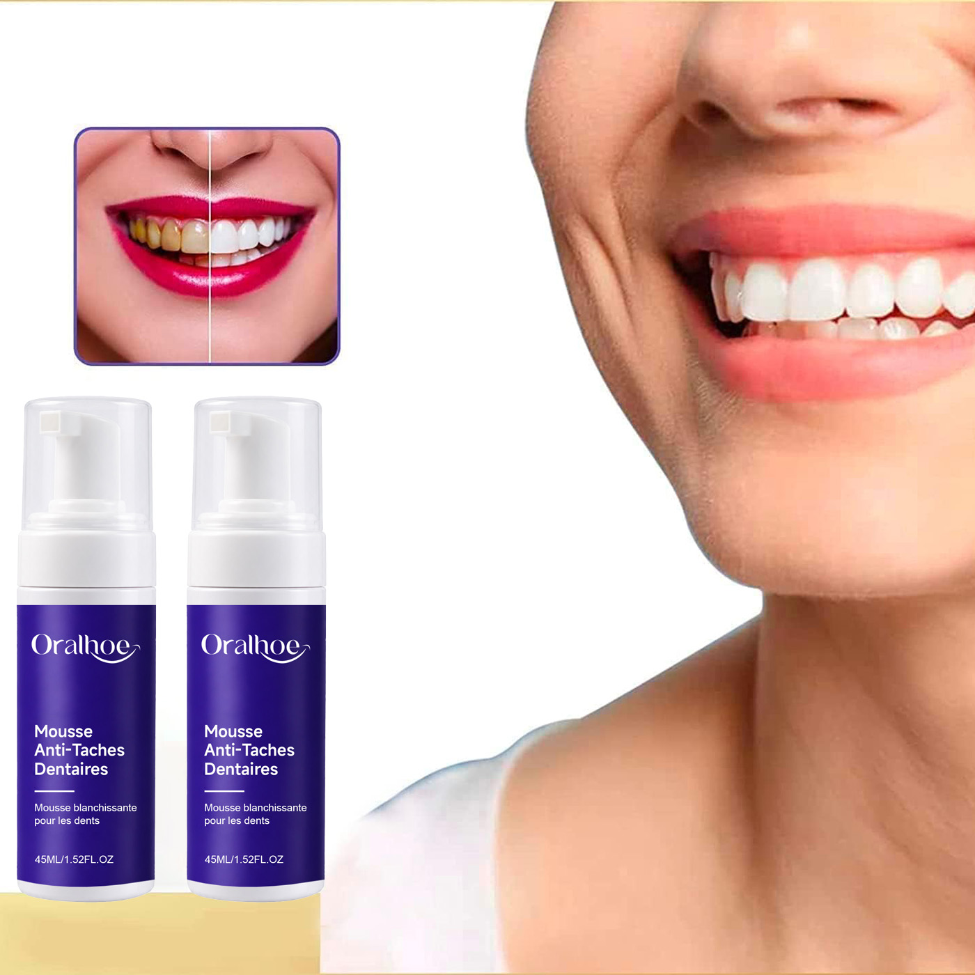Purple Foaming Teeth Whitening – обзор и цена Teeth Whitening Routine