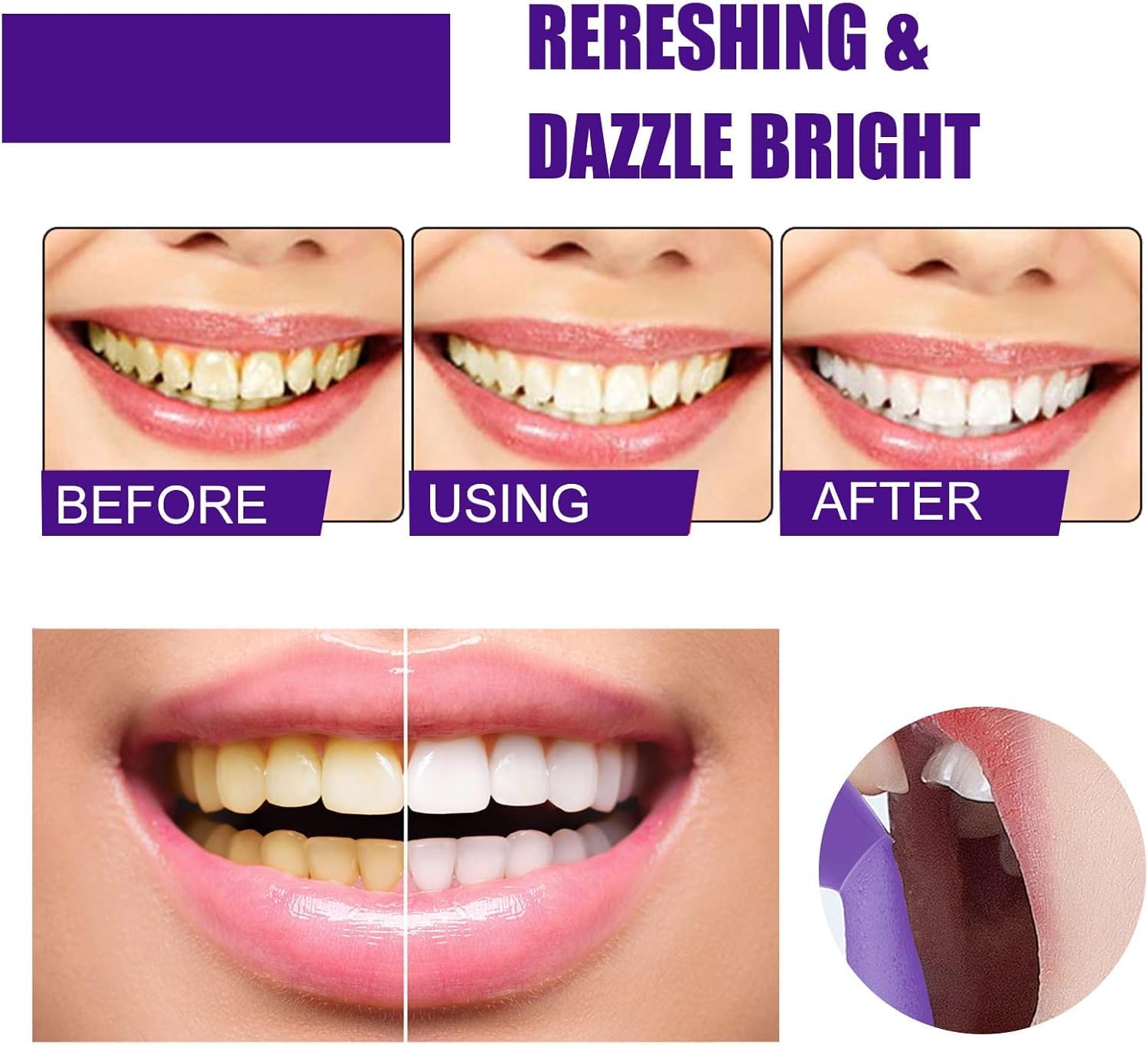 Purple Foaming Teeth Whitening – обзор и цена Teeth Whitening Routine