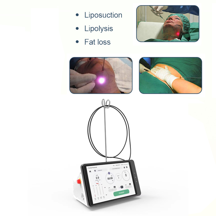 Dental Laser Teeth Whitening D – обзор и цена Teeth Whitening With Laser