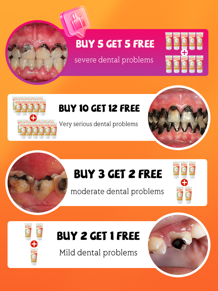 Repair tooth decay and whiten  – обзор и цена Teeth Whitening That Works