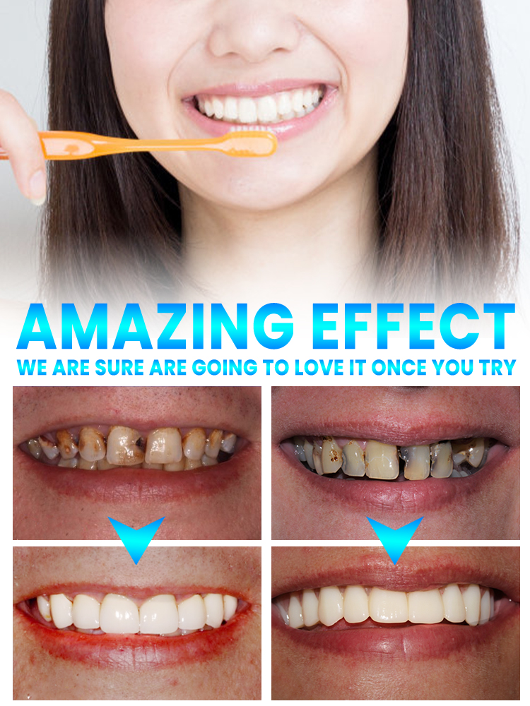 Repair tooth decay and whiten  – обзор и цена Teeth Whitening That Works