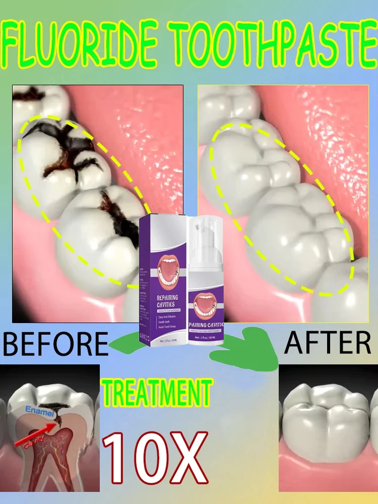 Hot sales Best-selling, Scient – обзор и цена Teeth Whitening That Works