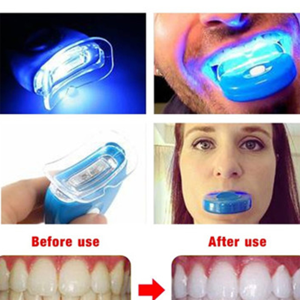 New Blue Led Teeth Whitening A – обзор и цена Teeth Whitening With Laser