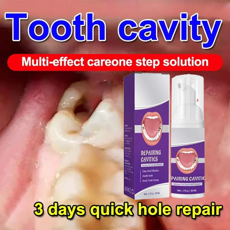 Teeth Cleaning Toothpaste Remo – обзор и цена Teeth Whitening That Works